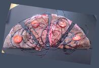 A M'arcord piada & cascioni